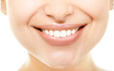 Teeth Whitening