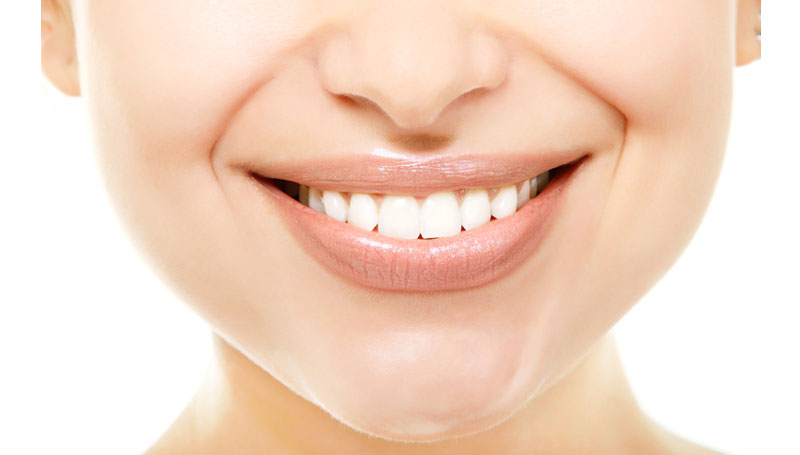 Teeth Whitening